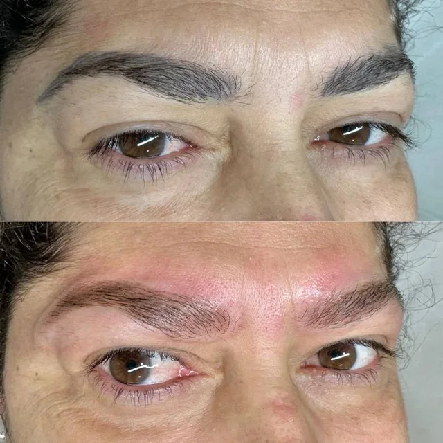 Sobrancelha grossa com excesso de pigmento